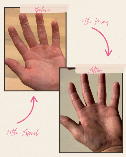 Cuticle Oil Dropper Bottle - Limited Edition French Pear